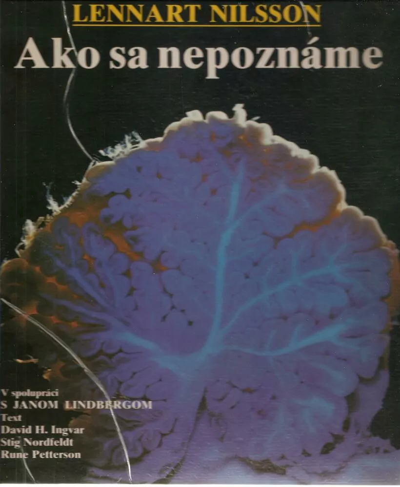 Ako sa nepoznáme