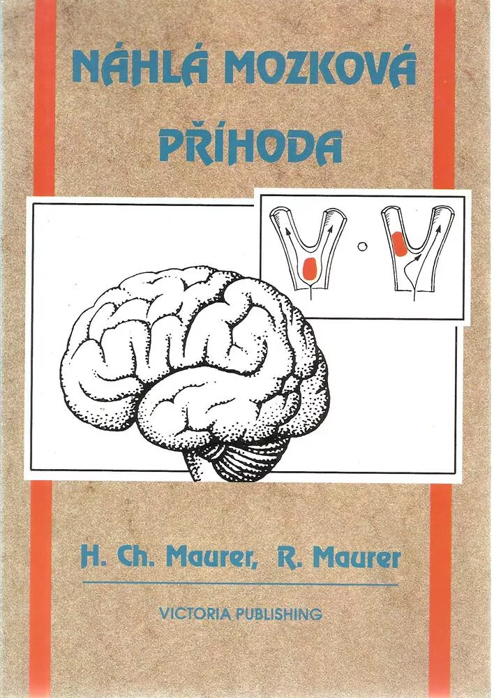 Náhlá mozková příhoda