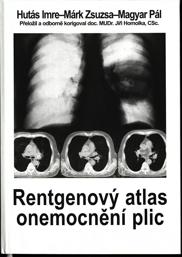 Rentgenový atlas onemocnění plic