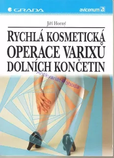 Rychlá kosmetická operace varixů dolních končetin