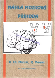Náhlá mozková příhoda